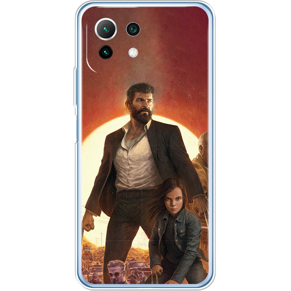 Xiaomi Case - Logan-2 - Mfest