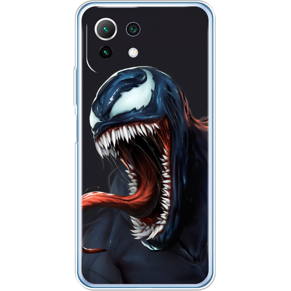 Xiaomi Case - VENOM [3] - Mfest