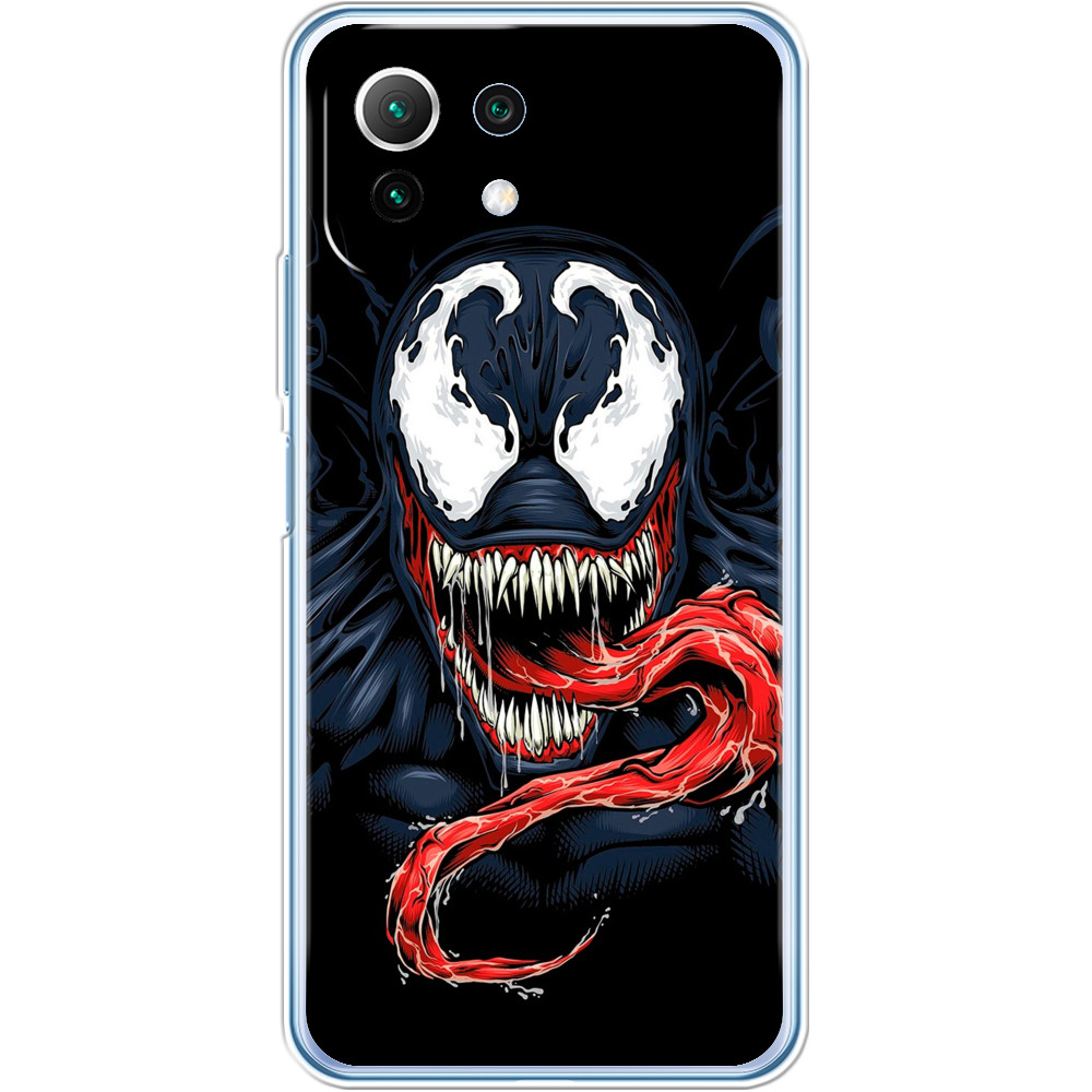 Xiaomi Case - VENOM [4] - Mfest