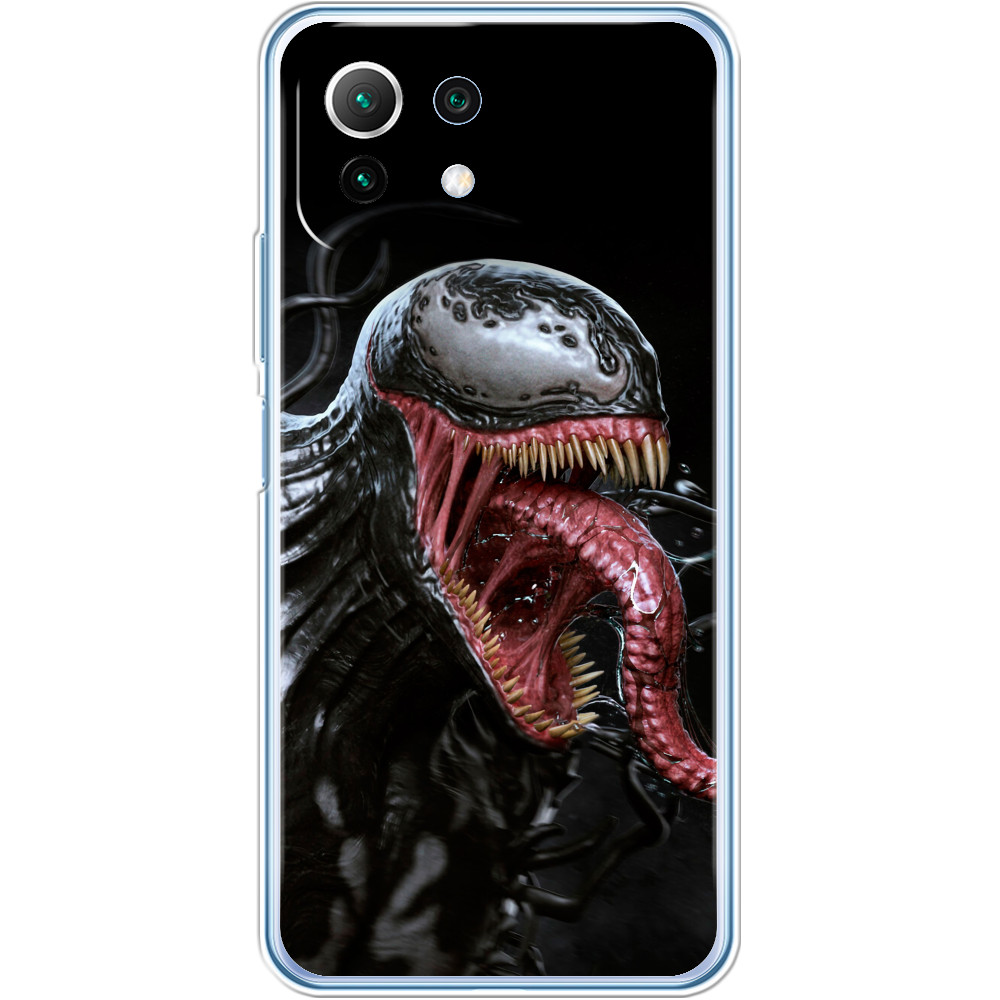 Xiaomi Case - VENOM [1] - Mfest